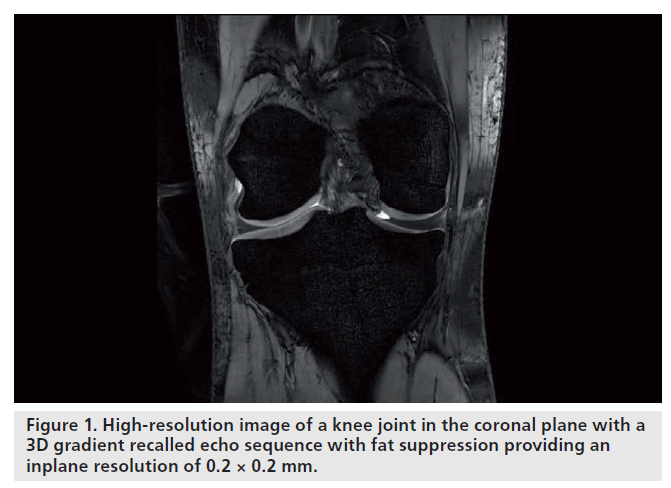 imaging-in-medicine-coronal-plane
