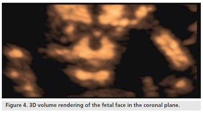 imaging-in-medicine-coronal-plane