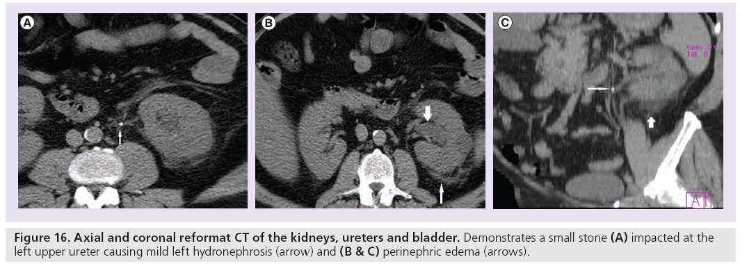 imaging-in-medicine-coronal-reformat