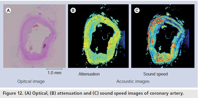 imaging-in-medicine-coronary-artery