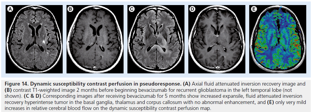 imaging-in-medicine-corpus-callosum