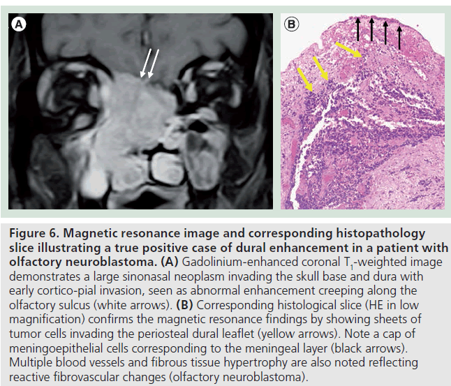 imaging-in-medicine-corresponding-histopathology