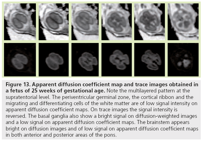 imaging-in-medicine-cortical-ribbon