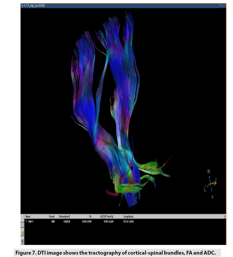imaging-in-medicine-cortical-spinal