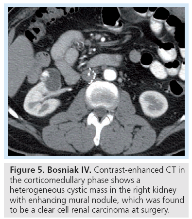 imaging-in-medicine-corticomedullary-phase