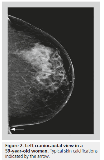 imaging-in-medicine-craniocaudal-view