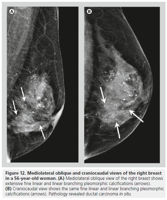 imaging-in-medicine-craniocaudal-view