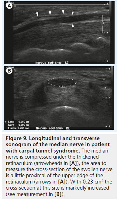 imaging-in-medicine-cross-section