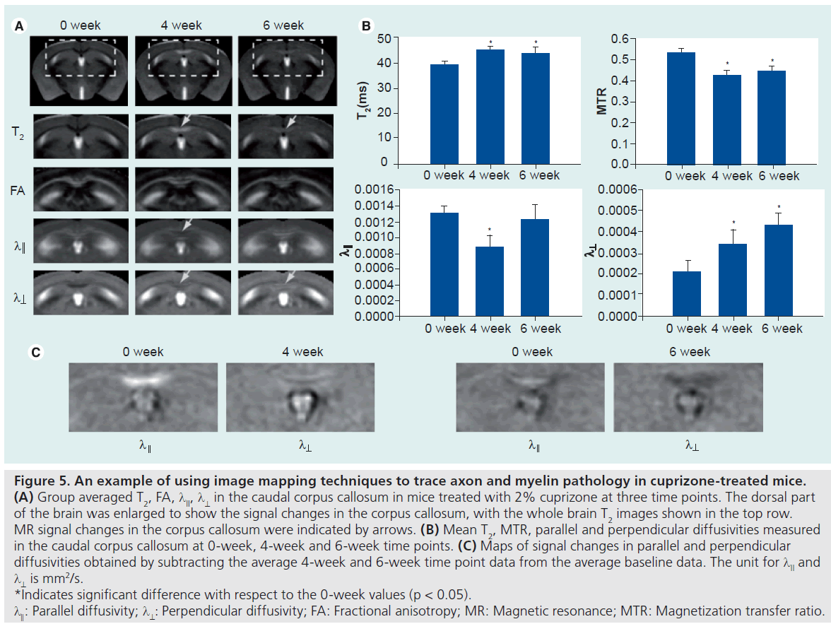 imaging-in-medicine-cuprizone-treated
