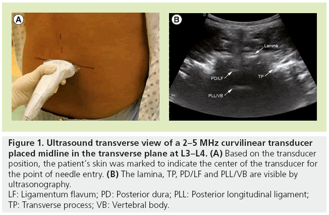 imaging-in-medicine-curvilinear-transducer