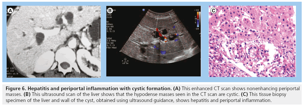 imaging-in-medicine-cystic-formation