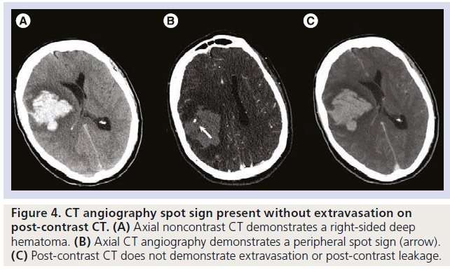 imaging-in-medicine-demonstrate-extravasation