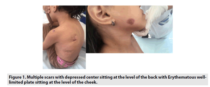 imaging-in-medicine-depressed-center