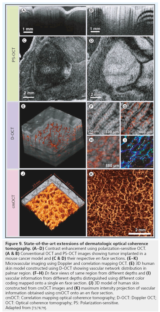 imaging-in-medicine-dermatologic-optical