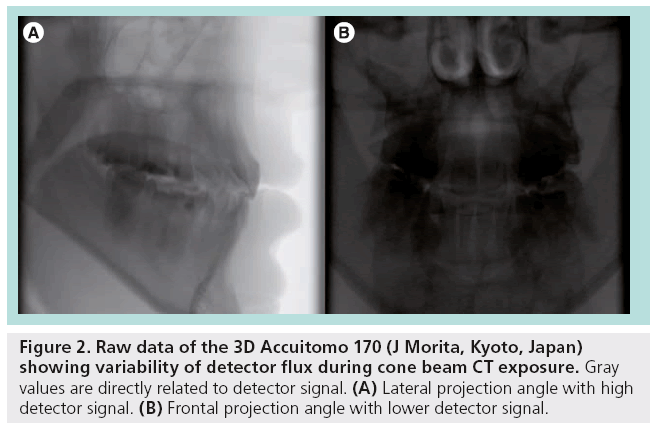 imaging-in-medicine-detector-flux