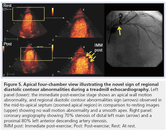 imaging-in-medicine-diastolic-contour