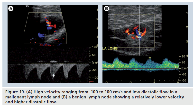imaging-in-medicine-diastolic-flow