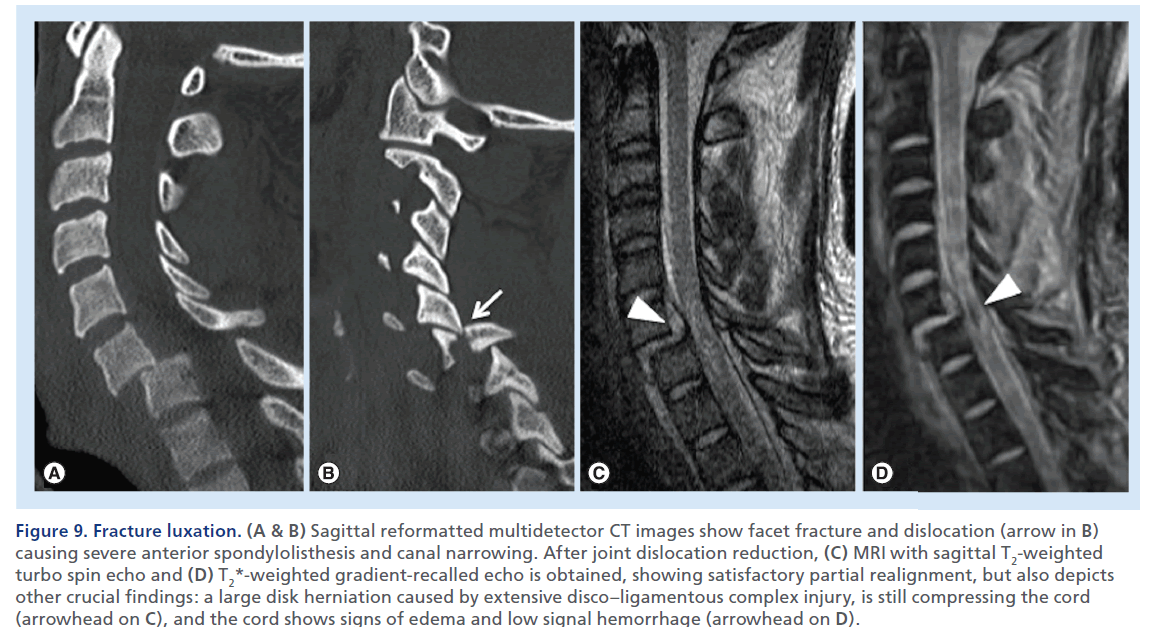 imaging-in-medicine-disco–ligamentous