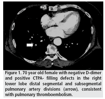 imaging-in-medicine-distal-segmental