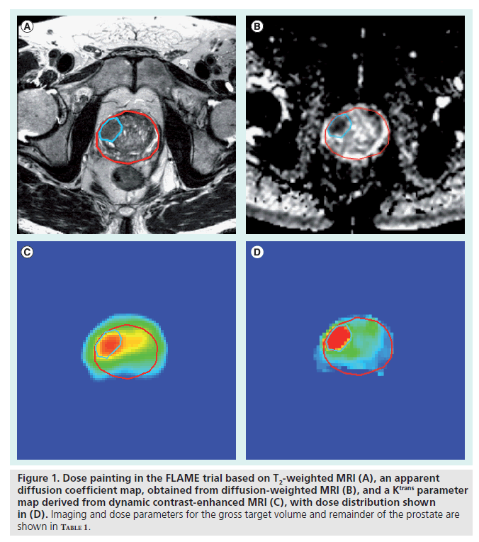 imaging-in-medicine-dose-parameters