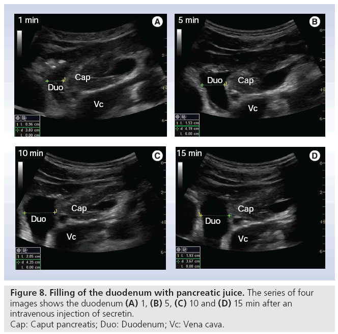 imaging-in-medicine-duodenum