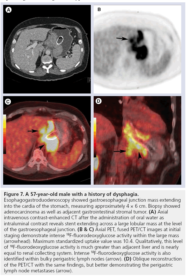 imaging-in-medicine-dysphagia