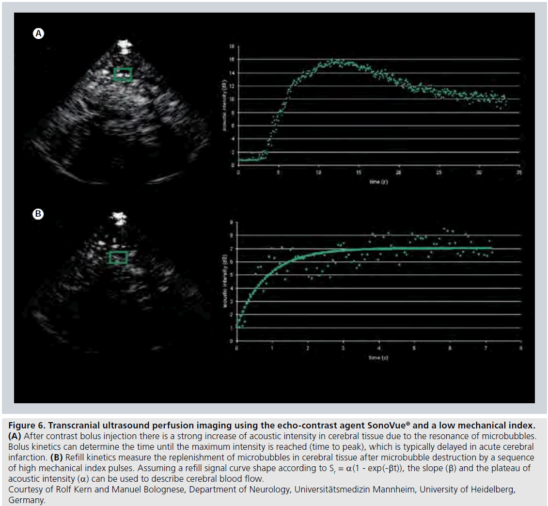 imaging-in-medicine-echo-contrast