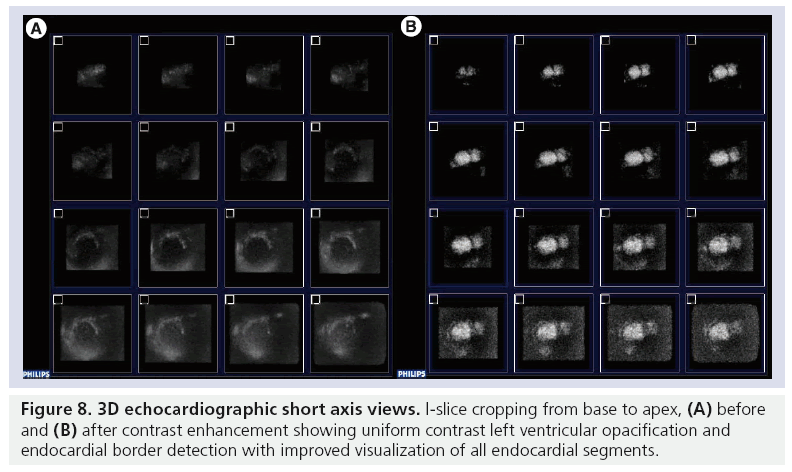 imaging-in-medicine-echocardiographic