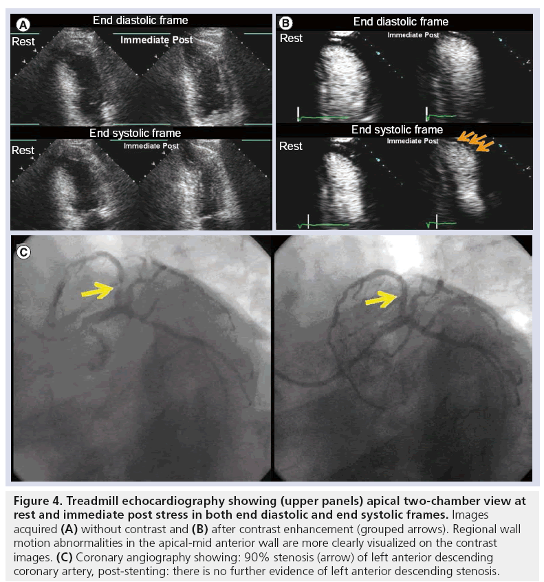 imaging-in-medicine-echocardiography