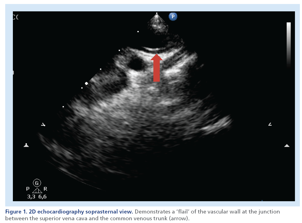 imaging-in-medicine-echocardiography