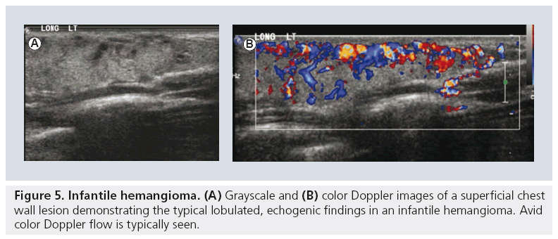 imaging-in-medicine-echogenic-findings