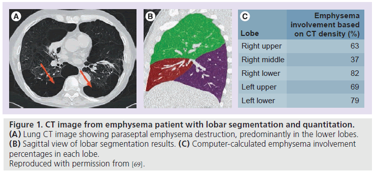 imaging-in-medicine-emphysema-destruction