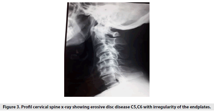imaging-in-medicine-endplates