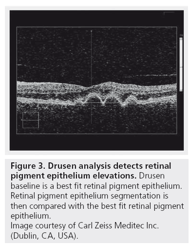 imaging-in-medicine-epithelium-elevations