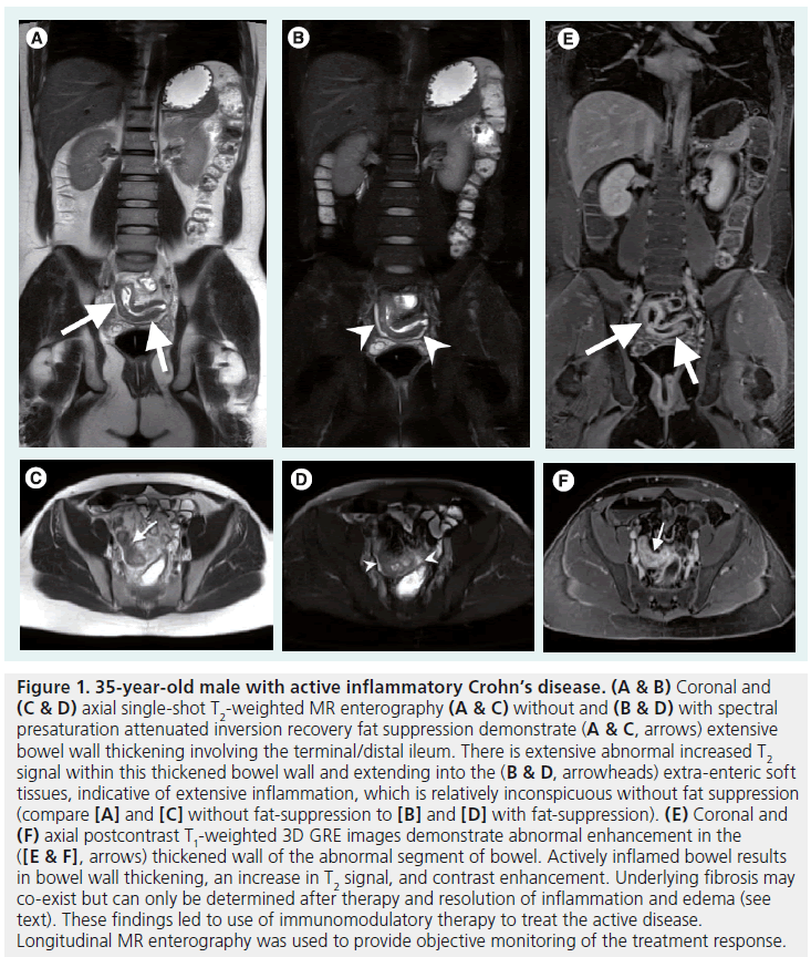 imaging-in-medicine-extensive-abnormal