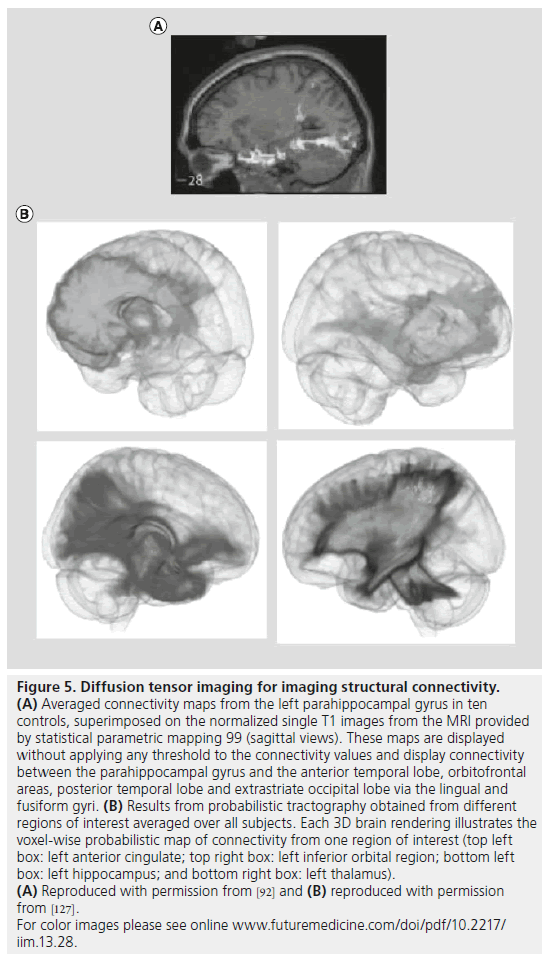 imaging-in-medicine-extrastriate-occipital