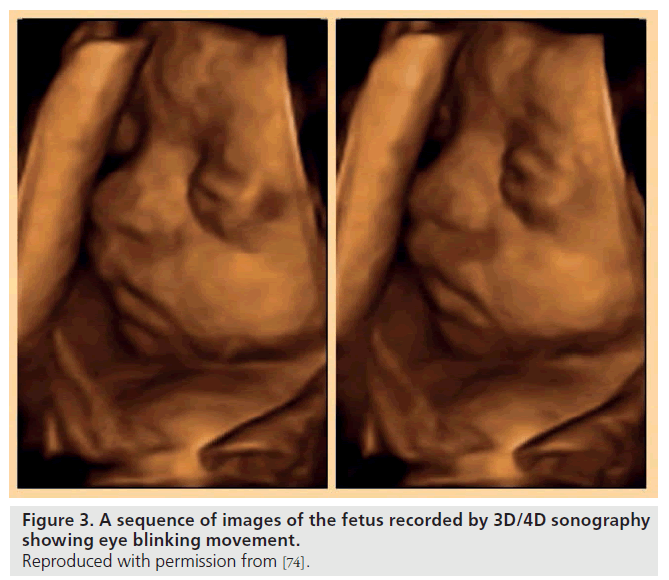 imaging-in-medicine-eye-blinking