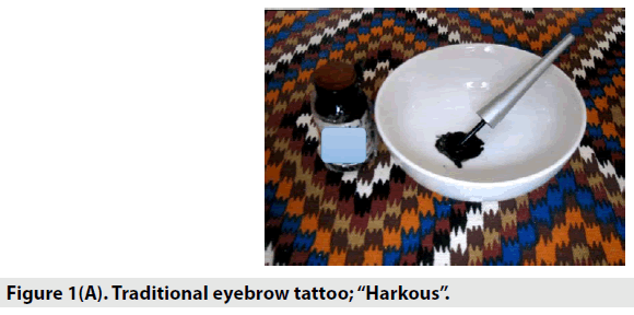 imaging-in-medicine-eyebrow-tattoo