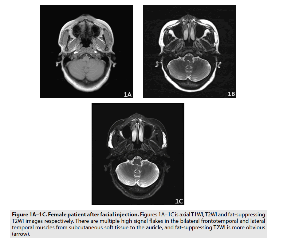 imaging-in-medicine-facial-injection