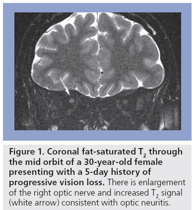 imaging-in-medicine-fat-saturated