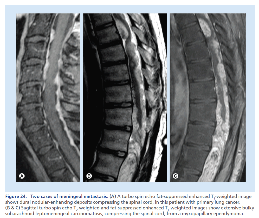 imaging-in-medicine-fat-suppressed