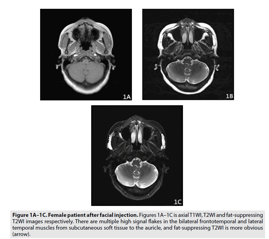 imaging-in-medicine-fat-suppressing