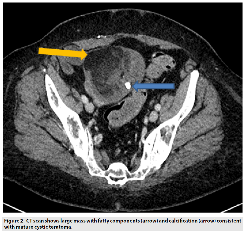 imaging-in-medicine-fatty-components
