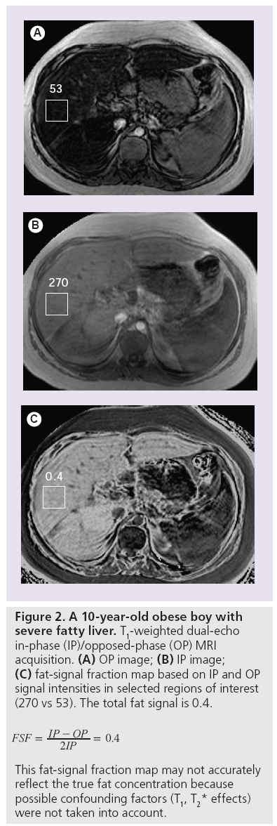 imaging-in-medicine-fatty-liver