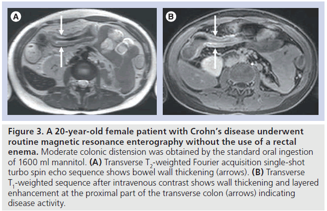 imaging-in-medicine-female-patient