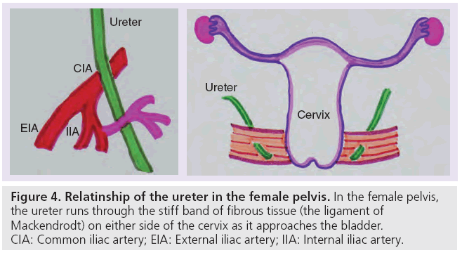 imaging-in-medicine-female-pelvis