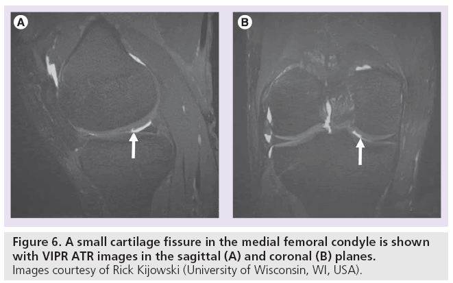 imaging-in-medicine-femoral-condyle