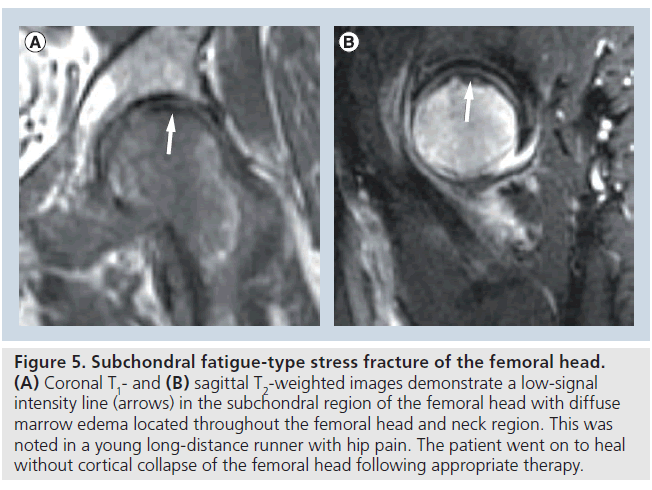 imaging-in-medicine-femoral-head