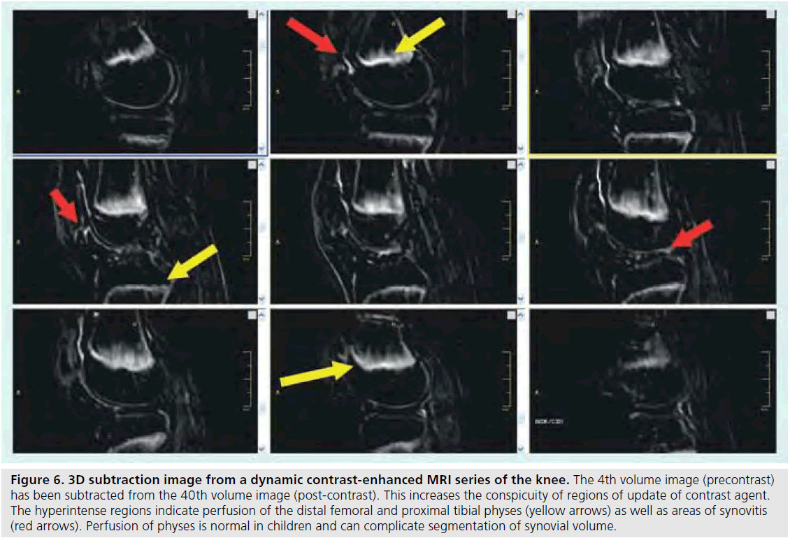 imaging-in-medicine-femoral-proximal