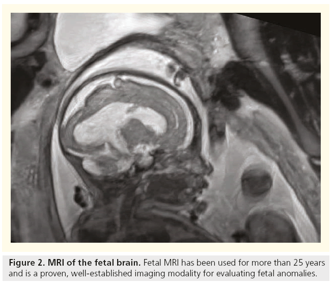 imaging-in-medicine-fetal-brain